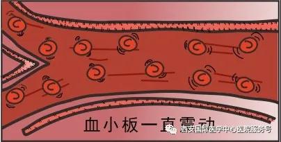 【科普】血小板是正常值的三倍？專家提醒小心血栓和出血！