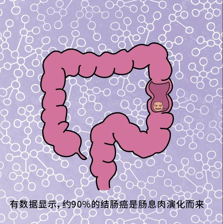 奪走“黑豹”生命的結(jié)腸癌，到底什么來頭？