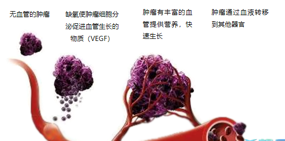 晚期腫瘤為什么會復發(fā)轉移？