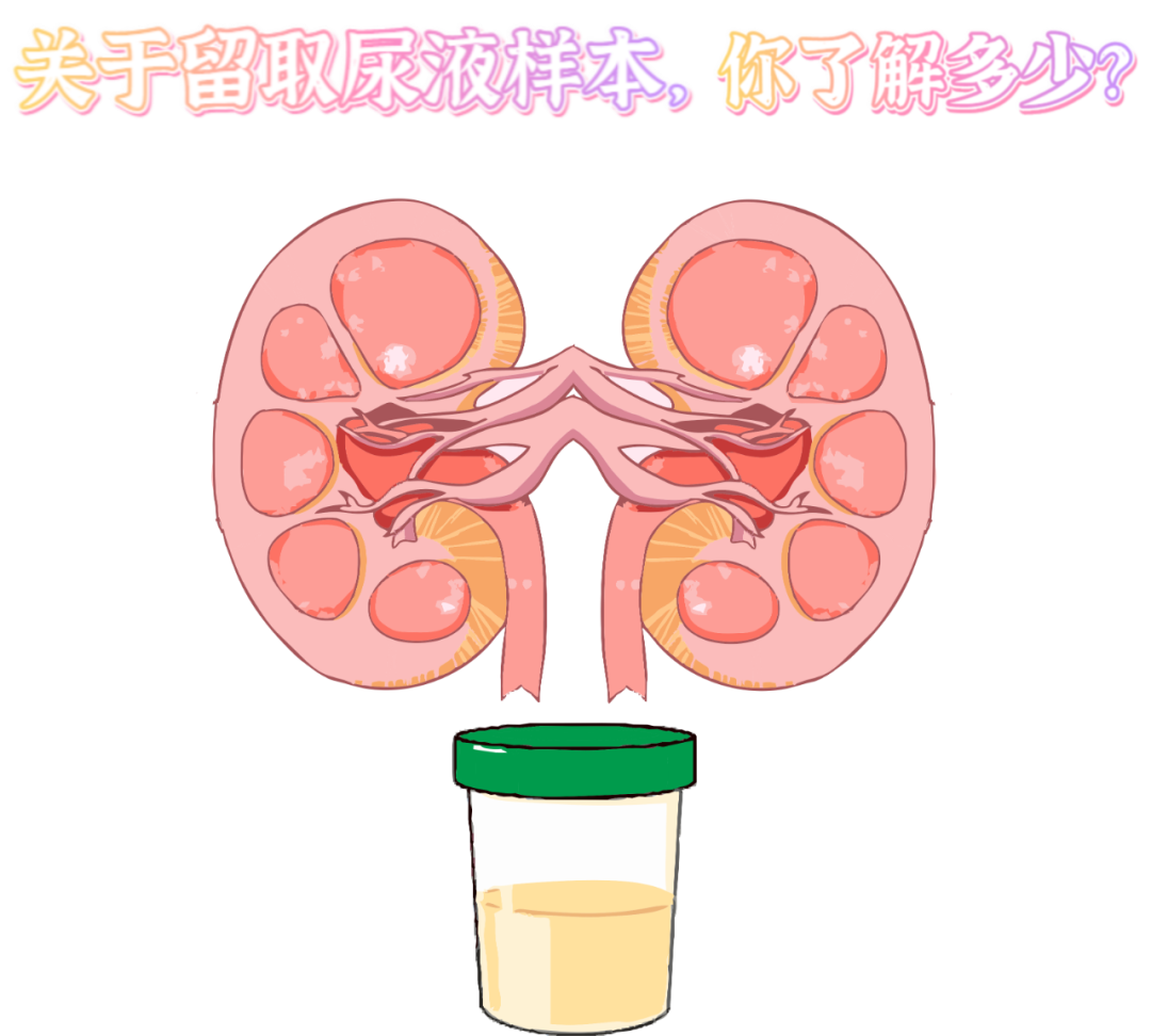 做尿檢，不得不說的注意事項(xiàng)！