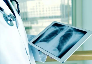 健康呼吸④體檢發(fā)現(xiàn)肺結(jié)節(jié)，我該怎么辦？