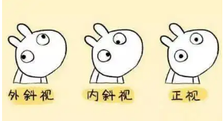 小baby老歪著頭？警惕斜頸! 這樣糾正……