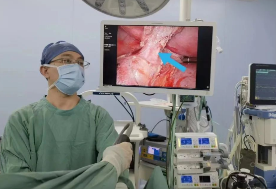 30歲小伙持續(xù)發(fā)燒咳嗽，原來是多長一塊肺......