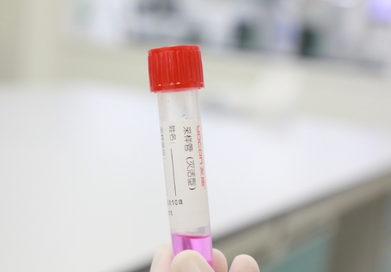 支原體感染檢測手段知多少？