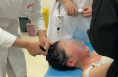 14歲，面、頸、胸燙傷，只因中午那鍋面湯…