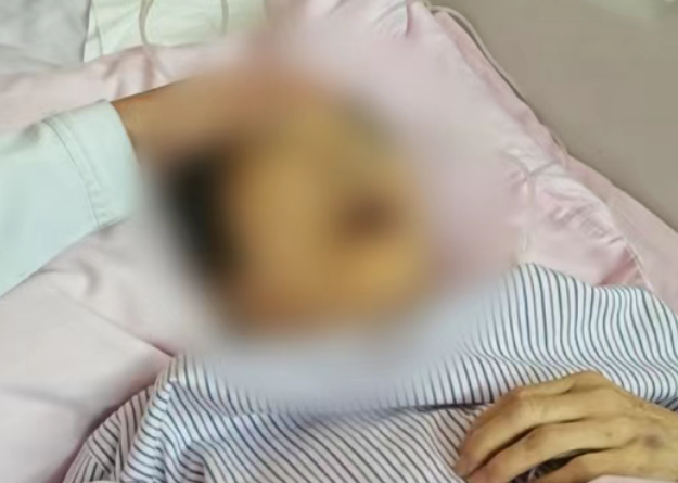 病房突發(fā)意外：老人痛苦拔管后，監(jiān)護(hù)儀瘋狂報(bào)警